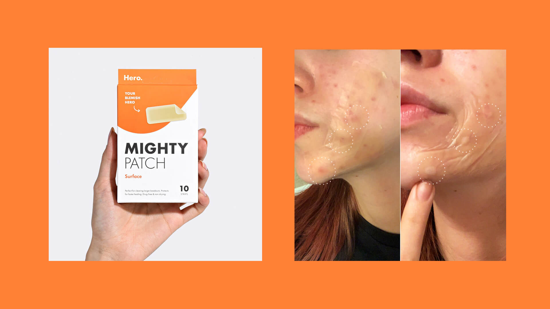 Skincare brand by HERO - Before and after results photo content